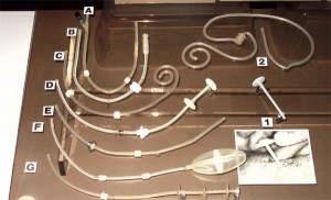 Peritoneal Dialysis Catheters