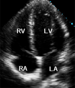 Information Dialysis
