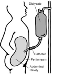 Diagram of peritoneum